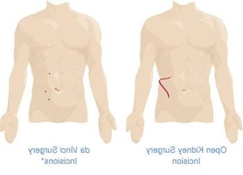 Urology